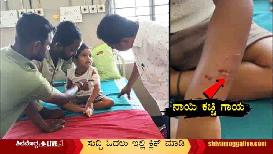 Dog-Attack-on-Child-in-Shimoga-PUrle