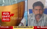 bear-attack-on-a-person-at-emmehatti-in-bhadravathi