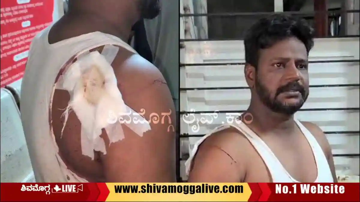 ಶಿವಮೊಗ್ಗದಲ್ಲಿ ಕಾರ್ ಡೀಲರ್, ಸಹೋದರನ ಮೇಲೆ ದುಷ್ಕರ್ಮಿಗಳ ದಾಳಿ, ಆಸ್ಪತ್ರೆಗೆ ದಾಖಲು 1 Attack-on-Rahamath-Ulla-at-Tippu-Nagara-in-Shimoga